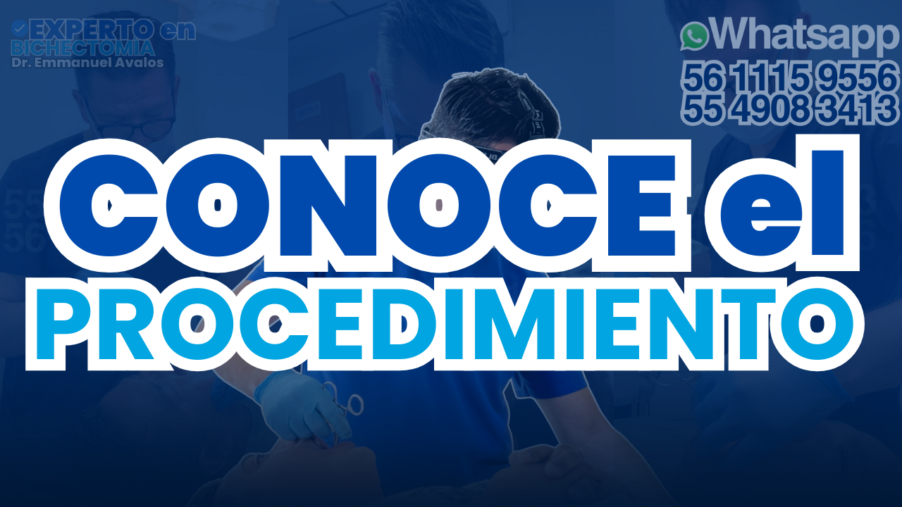 Conoce el procedimiento